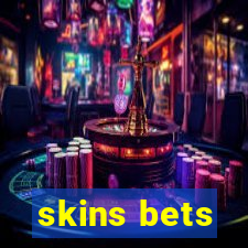 skins bets