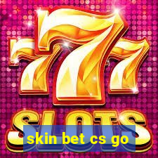 skin bet cs go